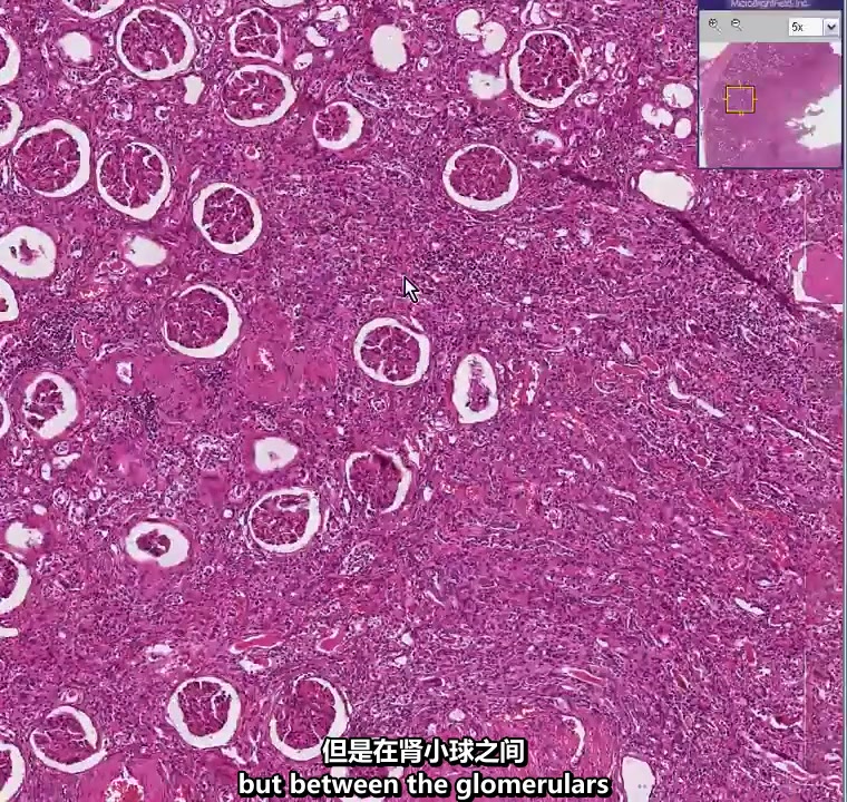 什么叫网络切割_网络切割方案_5G网络切割方式